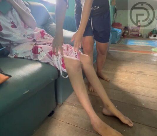 Video clip of 15-year-old disabled girl appearing to be attacked by group of male teenagers in Phuket goes viral on social media
