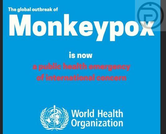 17 people at high-risk of monkey pox in Phuket being tested and monitored