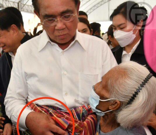 Thai Prime Minister Admitted to Hospital Due to Swollen Right Hand