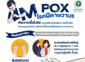 Thai Experts Warn of New Mpox Strain Risks